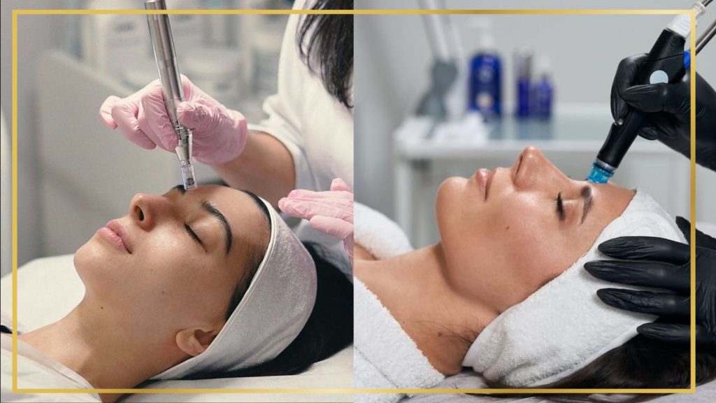 Microneedling vs Microdermabrasion comparison showing skin treatment